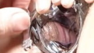 japanese URETHRA ILLUSTRATIONS2.mp4 japanese URETHRA ILLUSTRATIONS2.mp4