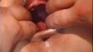 RoughFisting AsianGirl RoughFisting AsianGirl