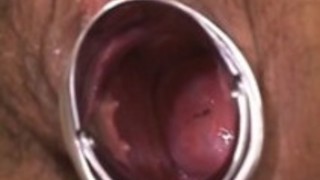 美里国仲看護師は、医療のツールやバイブレーターで犯されています 美里国仲看護師は、医療のツールやバイブレーターで犯されています